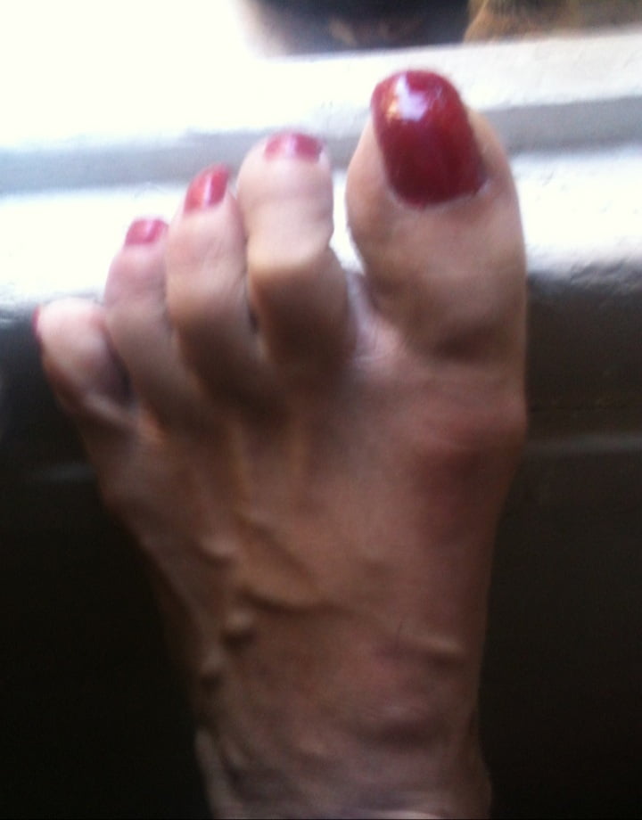 red toenails mix (older, soiled, toe ring, sandals mixed).
