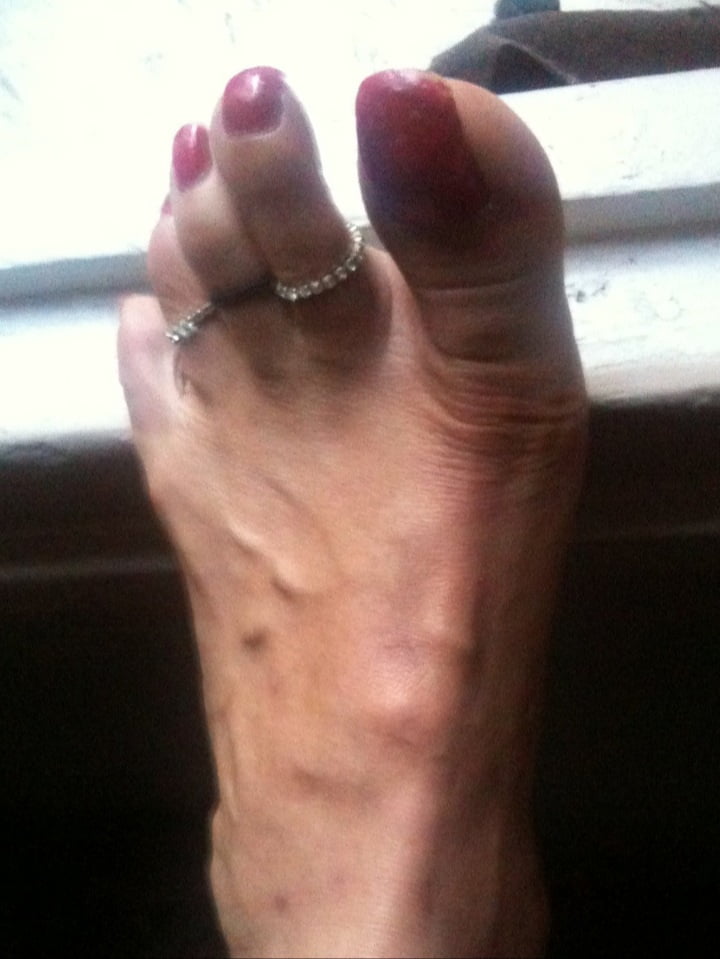 red toenails mix (older, dirty, toe ring, sandals mixed). #106916346