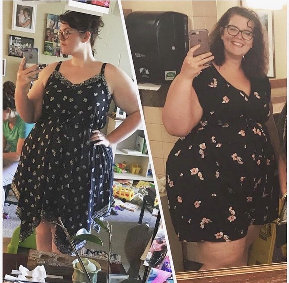 Aumento de peso antes y después 2
 #99546414