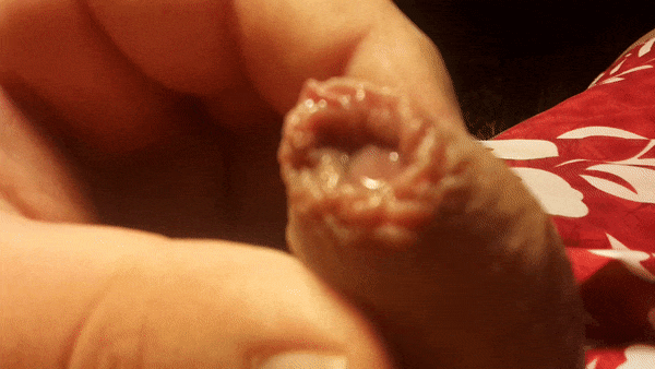 Winzig kleine Klitoris geschrumpft weich & hart
 #101047987