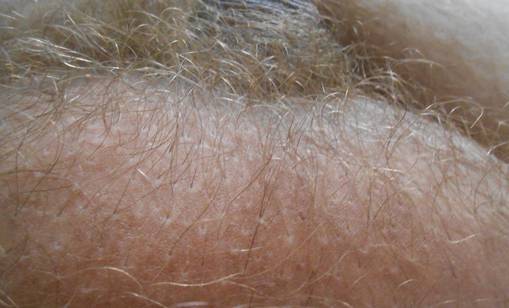 my tiny hairy dick before shaving #107094104