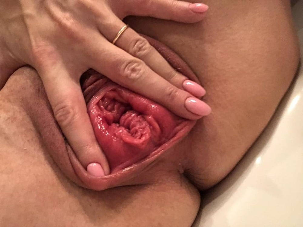 Prolaps Vagina
 #95313759