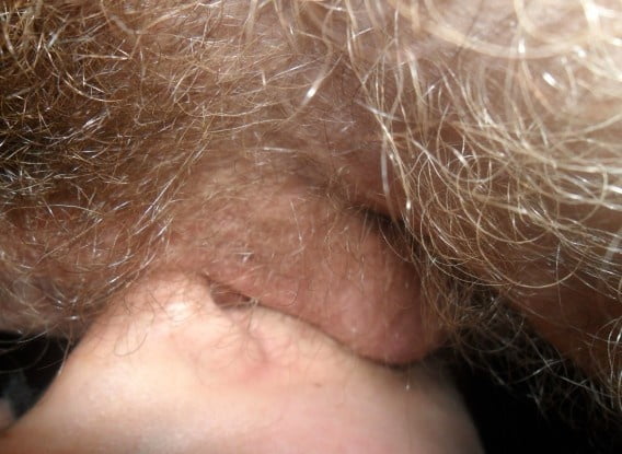 sexy ring #100631777