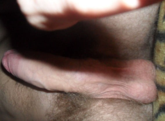 sexy ring #100631824