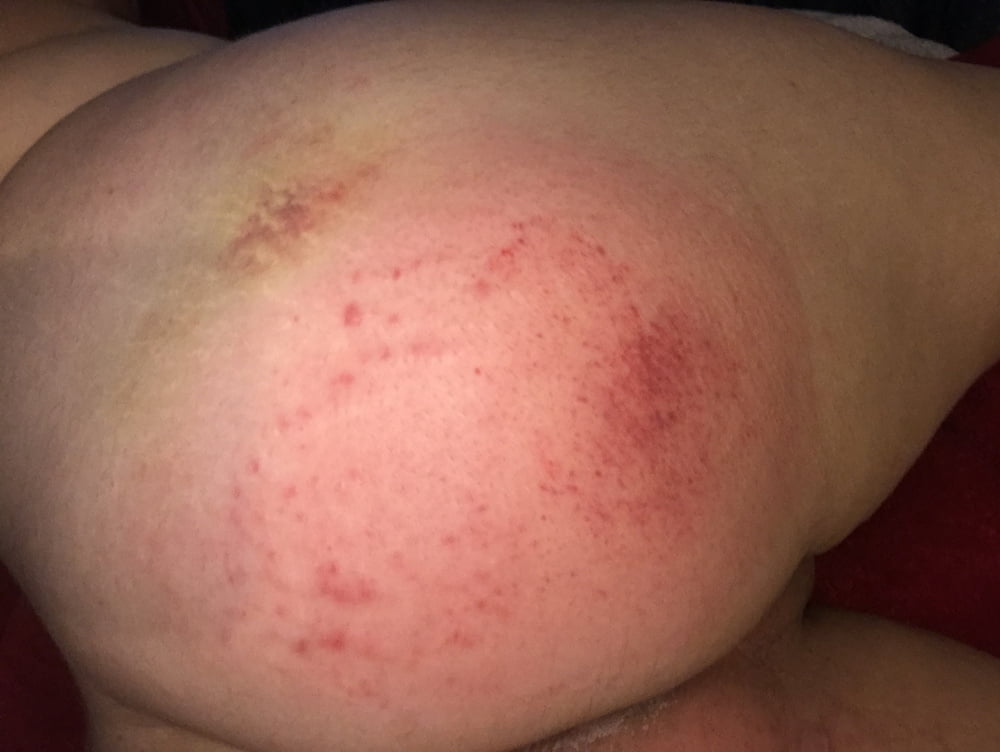 Posting my bottom after I&#039;m punished #107038902