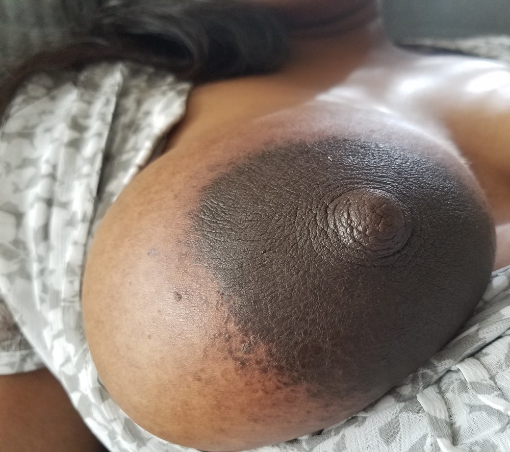 Dark target #80784319