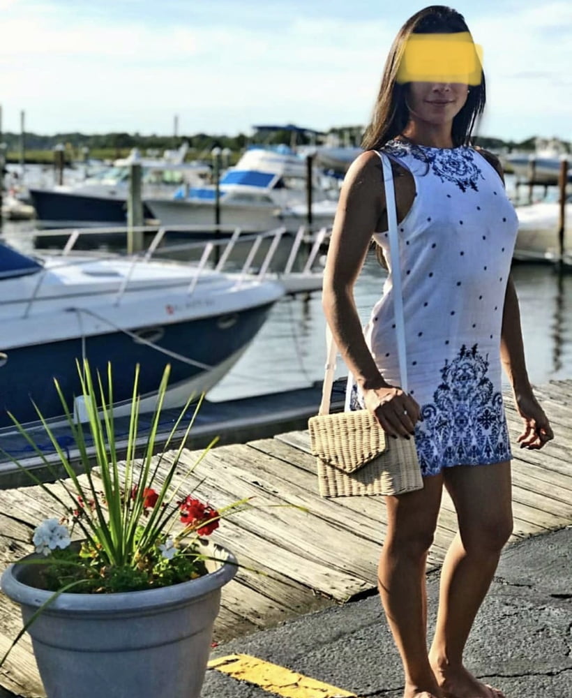 Antes y después
 #104979008