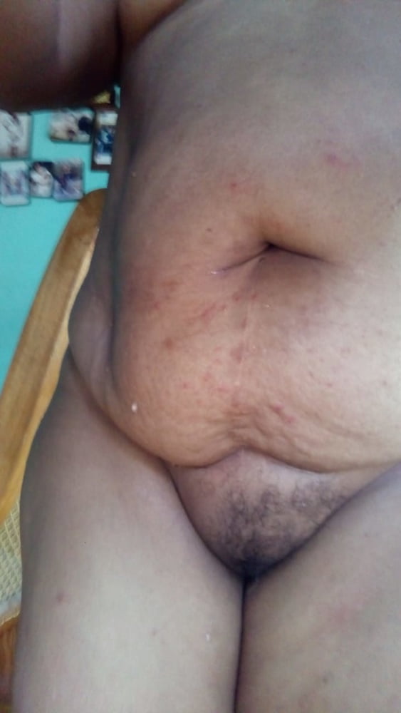 アレリ・マドゥラ
 #93756155