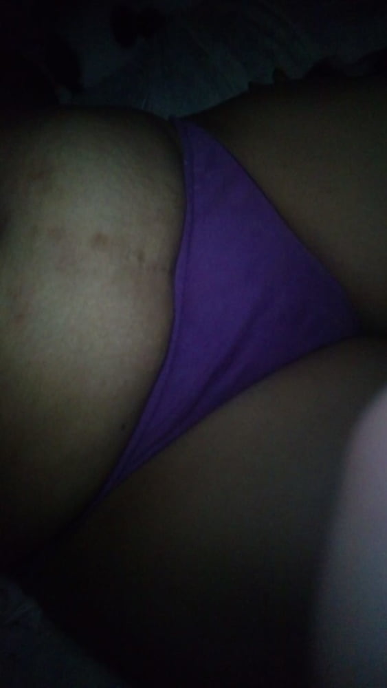 アレリ・マドゥラ
 #93756198