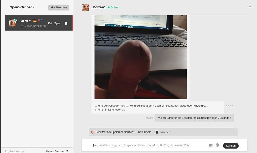 スピナーとスパッケン
 #101119690