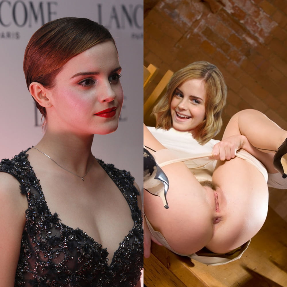 Prima e dopo emma watson
 #90649308