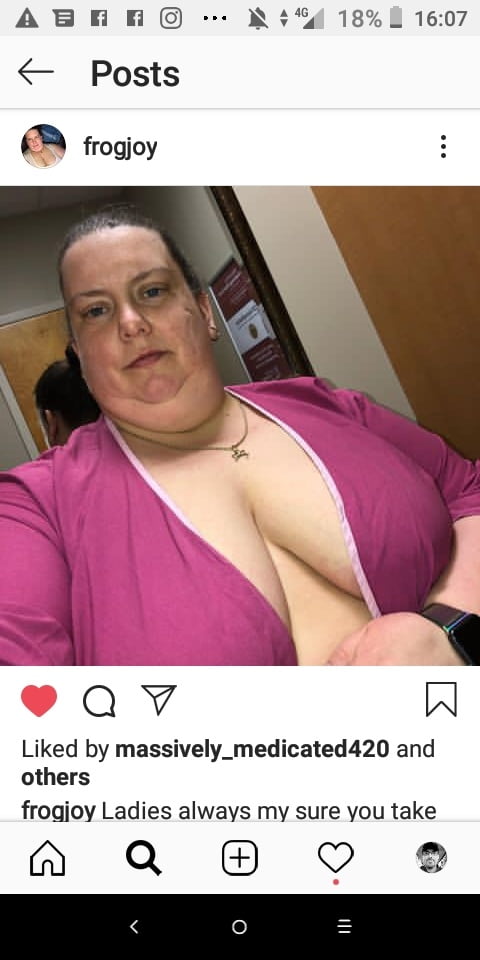 Hoodyman ssbbw 286 . fatkini screen shots
 #101377153