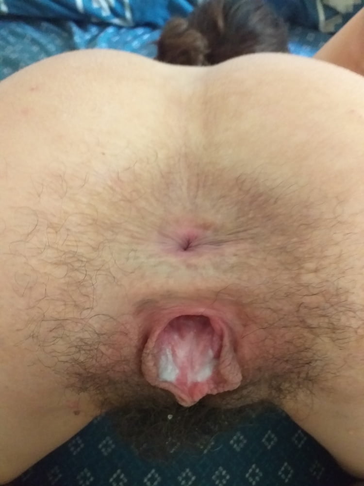 GAPING HAIRY PUSSY &amp; ASSHOLE #81907617