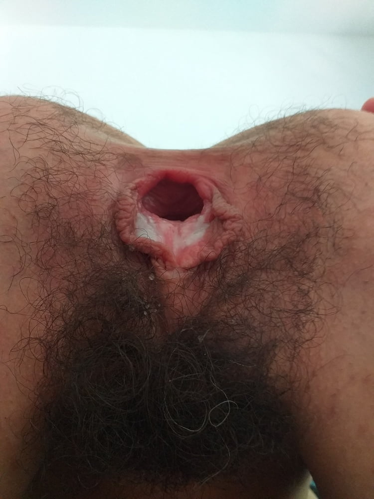 Gaping hairy pussy & asshole
 #81907618