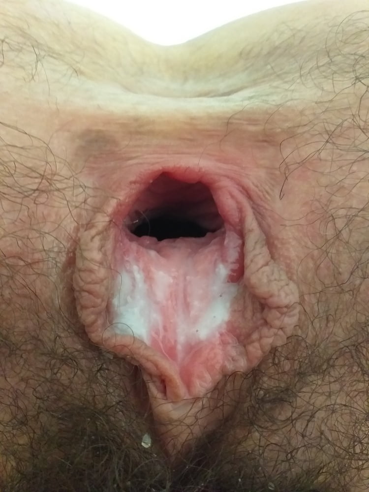 GAPING HAIRY PUSSY &amp; ASSHOLE #81907619