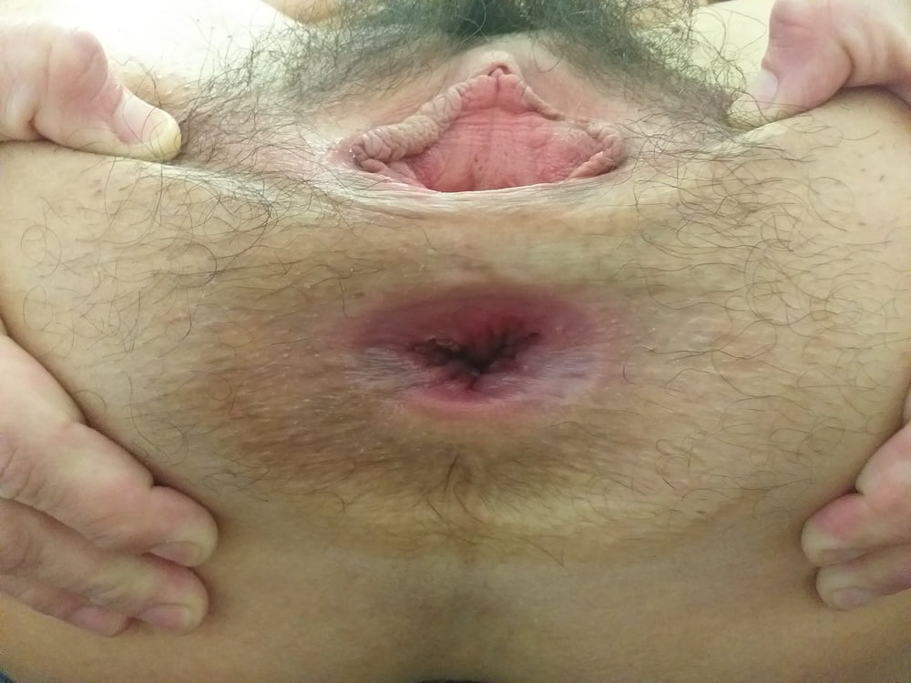 GAPING HAIRY PUSSY &amp; ASSHOLE #81907621