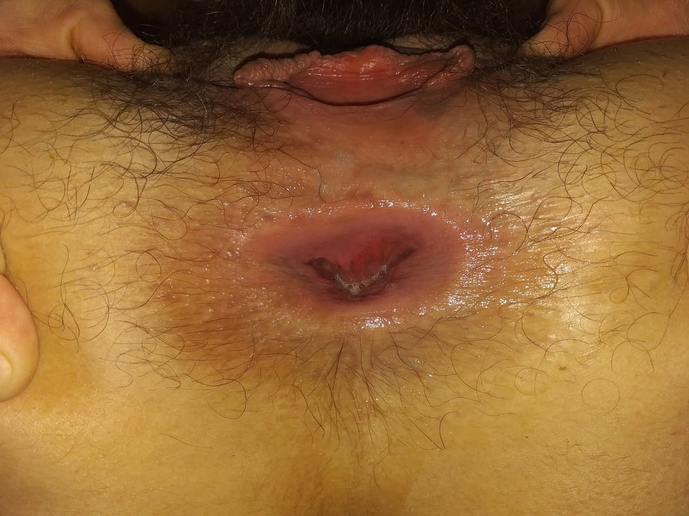 GAPING HAIRY PUSSY &amp; ASSHOLE #81907623