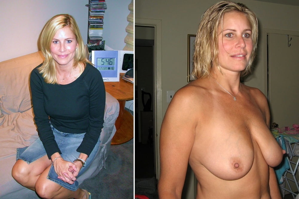 BEFORE AFTER 22 #100485748