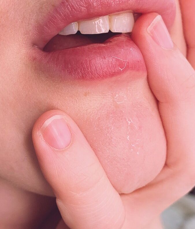 Isla David desnuda #109367596