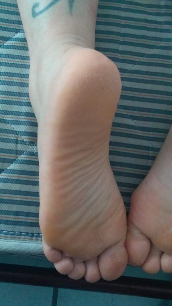 Rough heels and feet soles #80797275