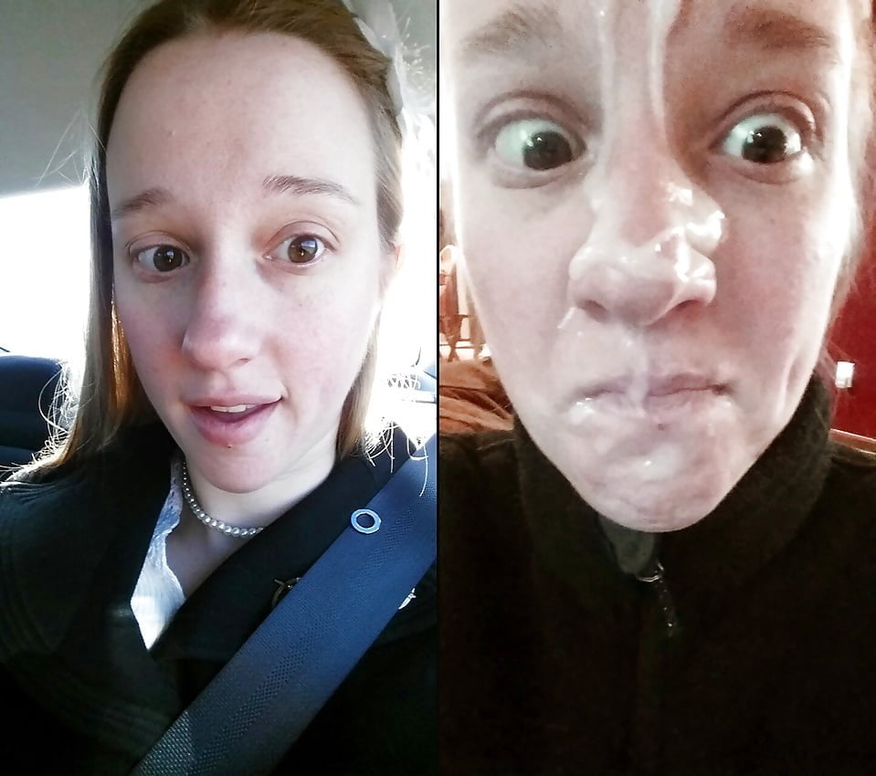 Facial Friday Before and after edition #103302832