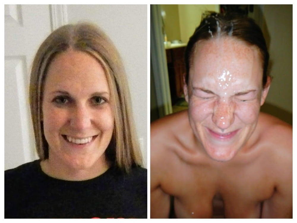Facial Friday Before and after edition #103302834