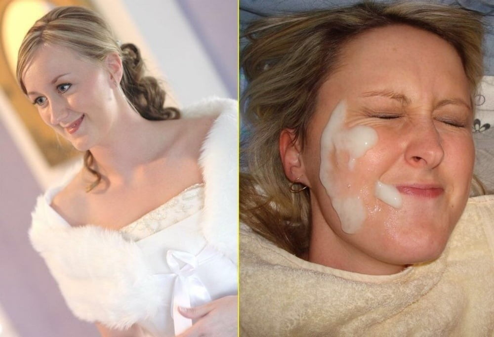 Facial Friday Before and after edition #103302836
