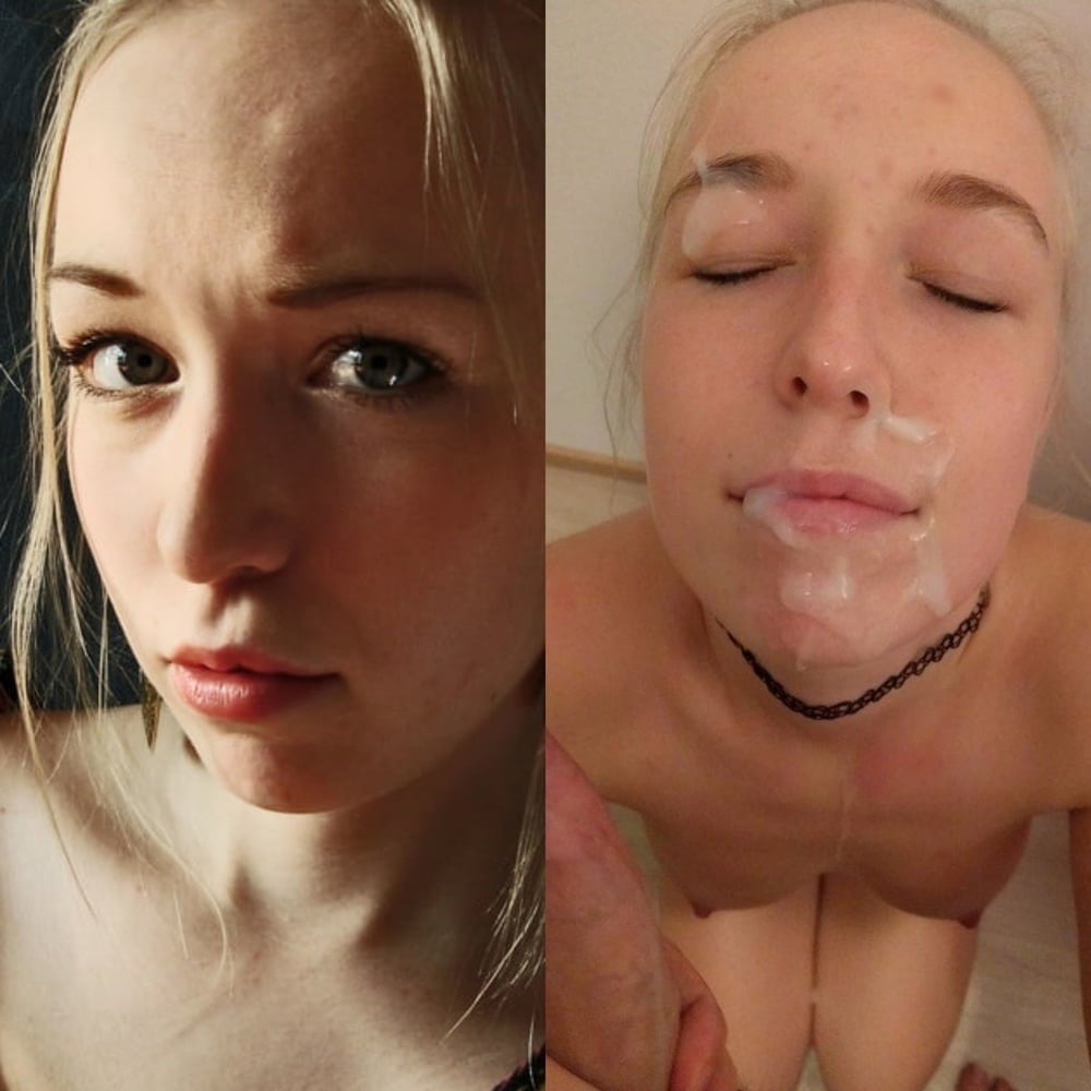 Facial Friday Before and after edition #103302841