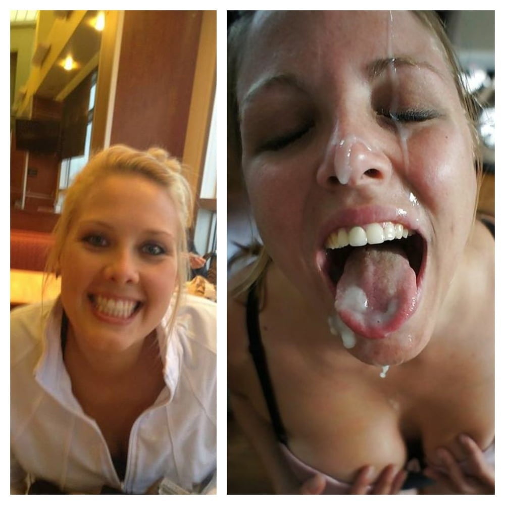 Facial Friday Before and after edition #103302842