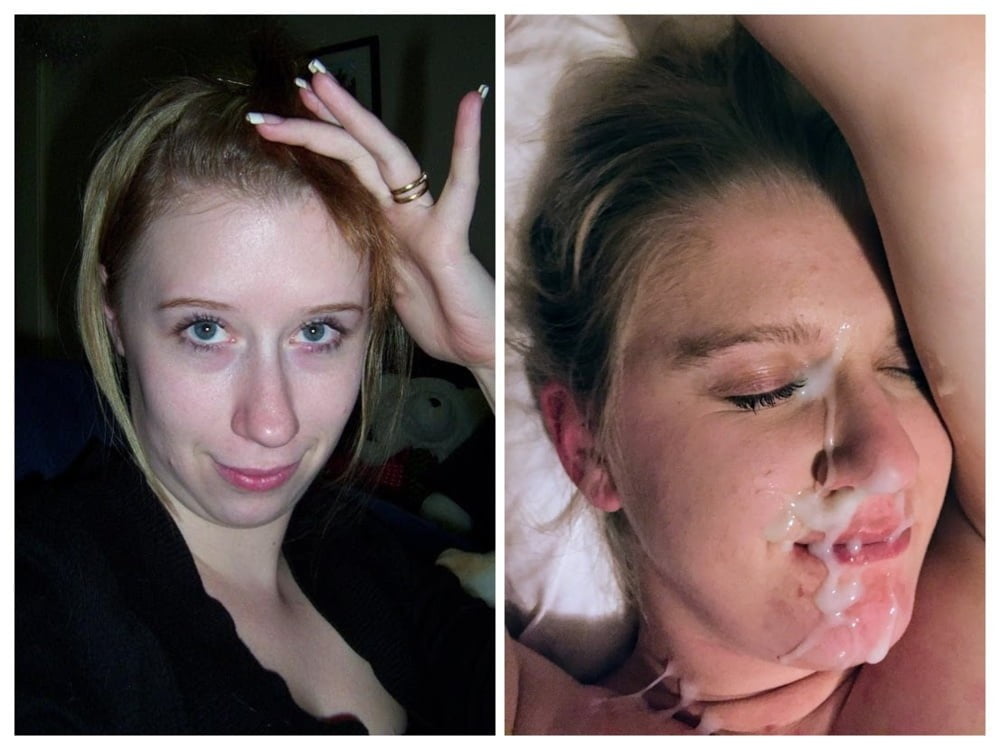 Facial Friday Before and after edition #103302856