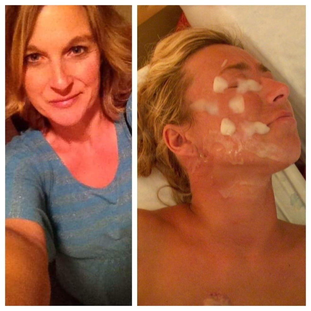 Facial Friday Before and after edition #103302869