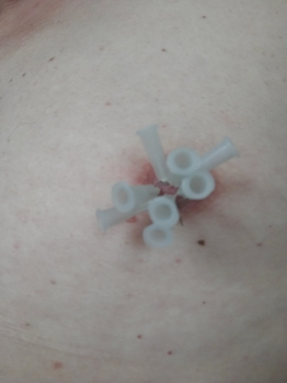 some more needles in my nipples #107007145