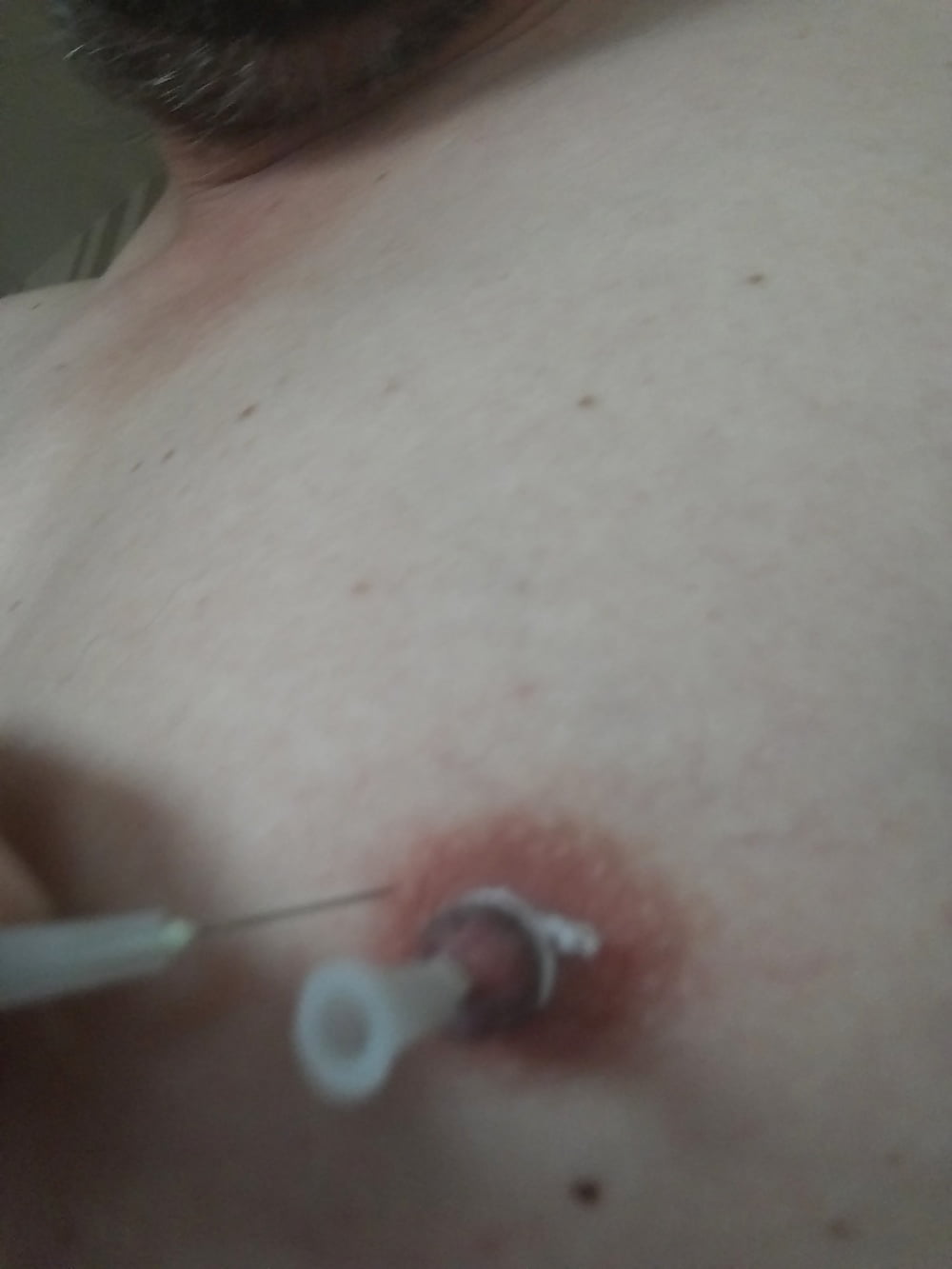 some more needles in my nipples #107007149