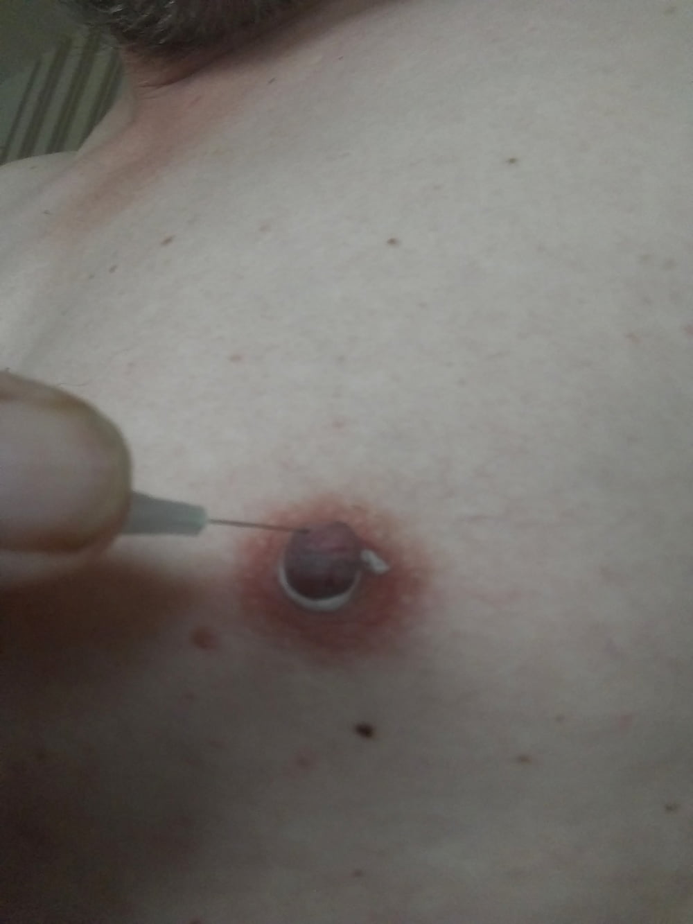 some more needles in my nipples #107007151