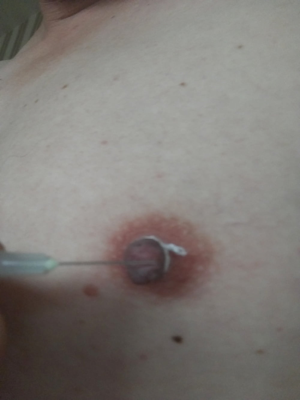 some more needles in my nipples #107007152