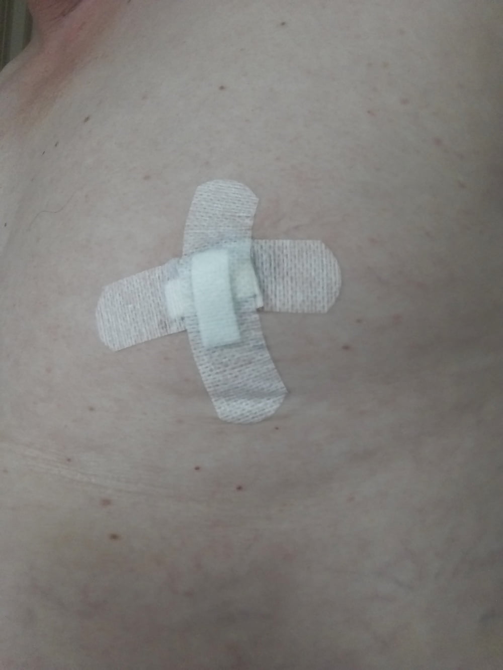 some more needles in my nipples #107007154
