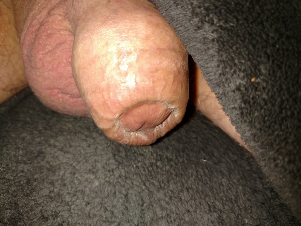 Circumcised penis #105670258