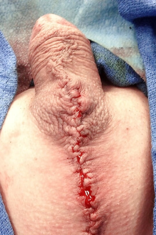 penis mods #107022647