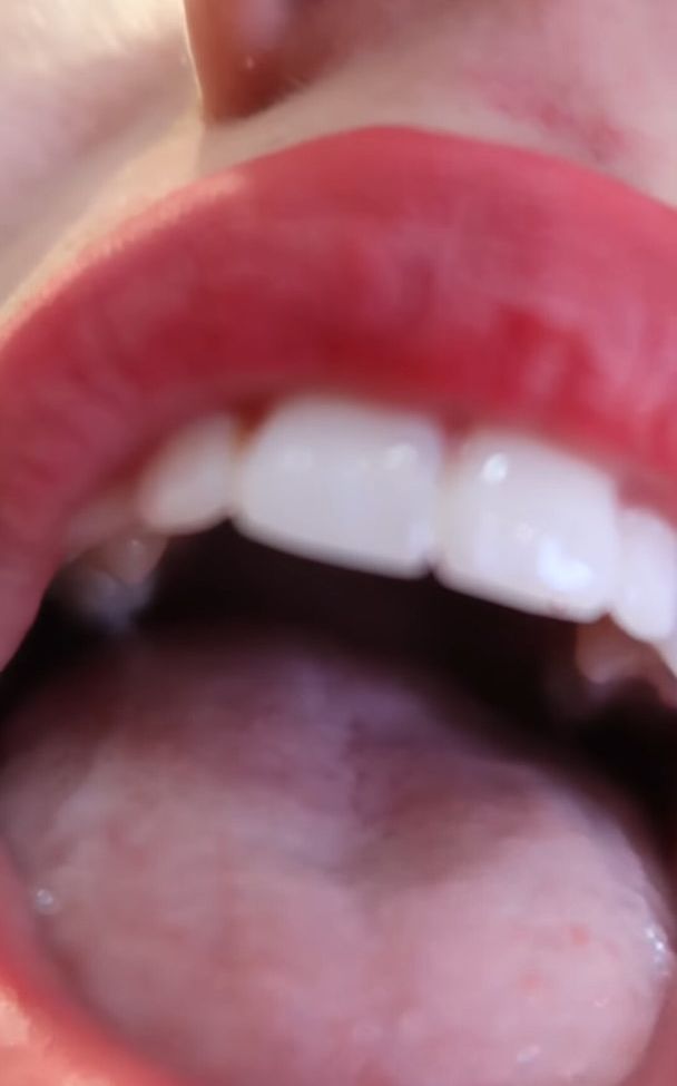 Colleen Ballinger desnuda #108096891