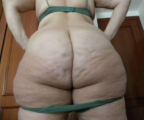 Best cellulite bums 7 #96017519