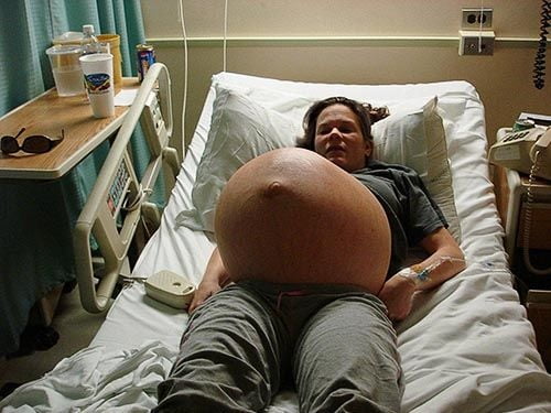 Enorme vientre y tetas embarazadas
 #79920701