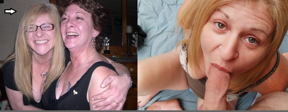 Before &amp; After #97409863