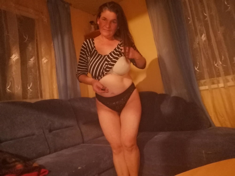 Collected and exposed DP #101230799