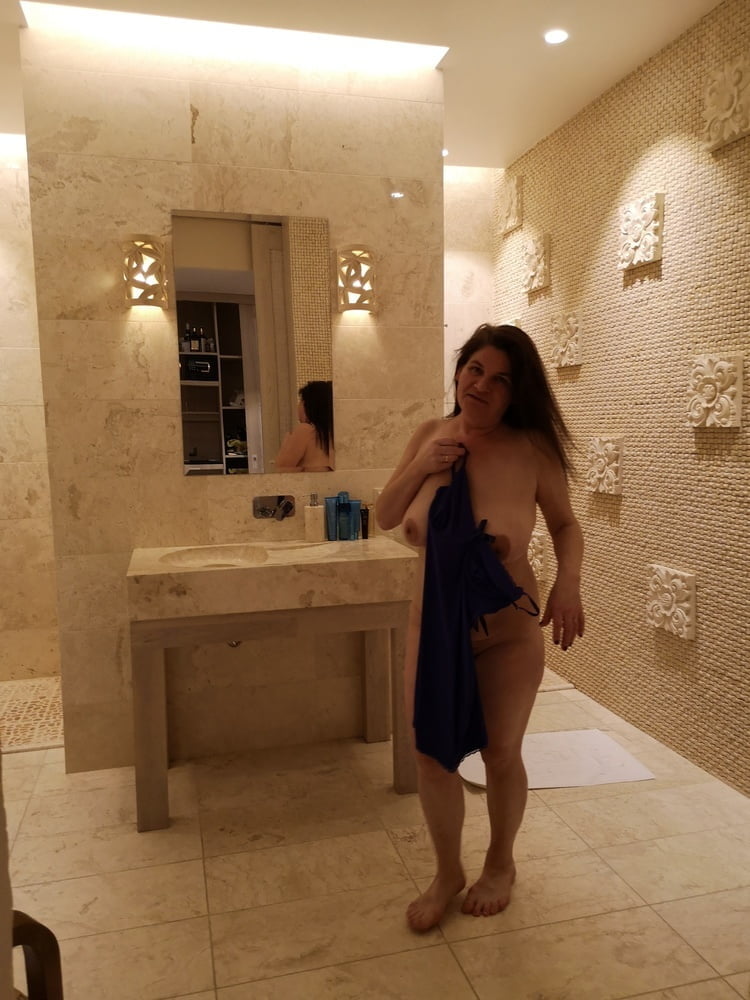 Collected and exposed DP #101230857