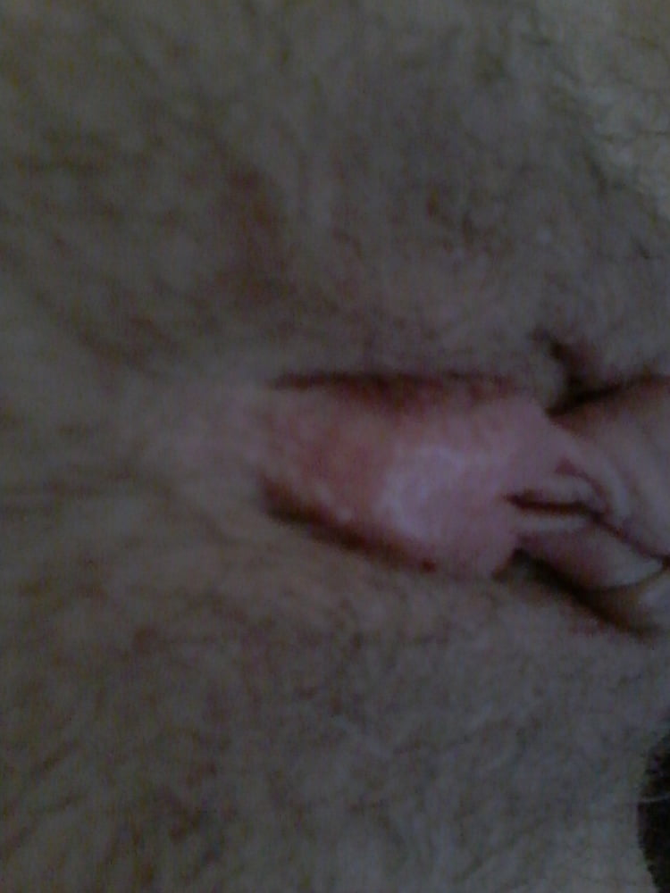 Clito pumping with seringue #95829990