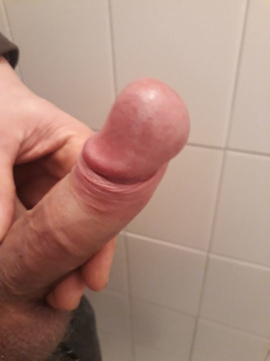 my dick #100104809