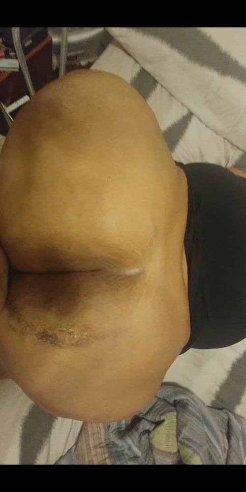 humongous ssbbw ass #91995754