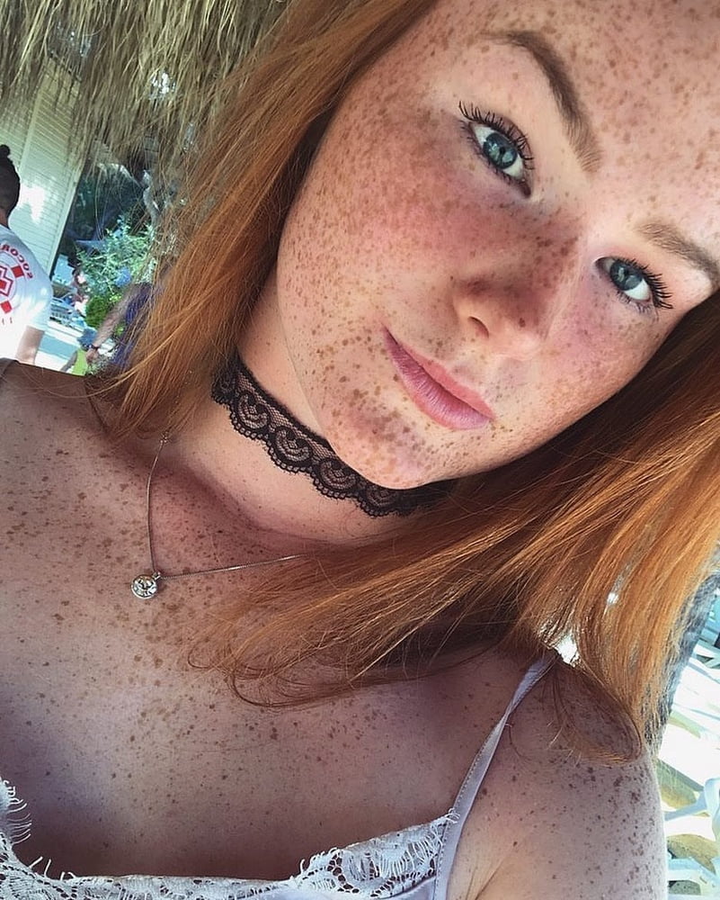 Freckled Beauty Victoria #99822560