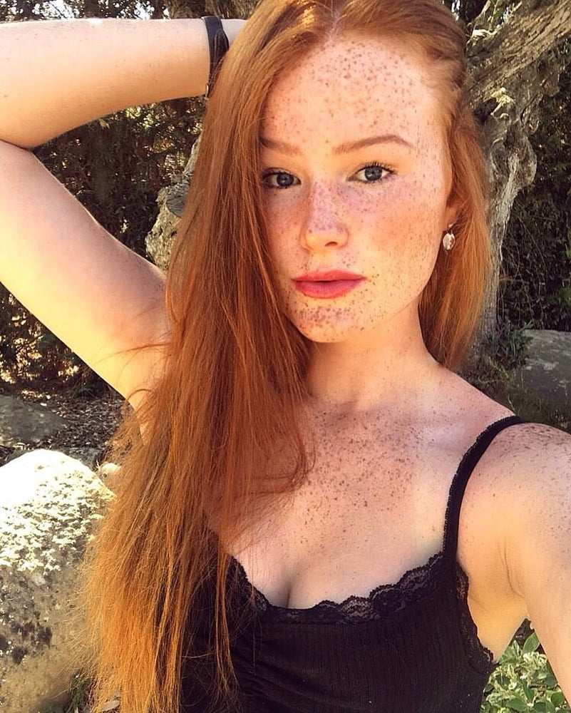 Freckled Beauty Victoria #99822605