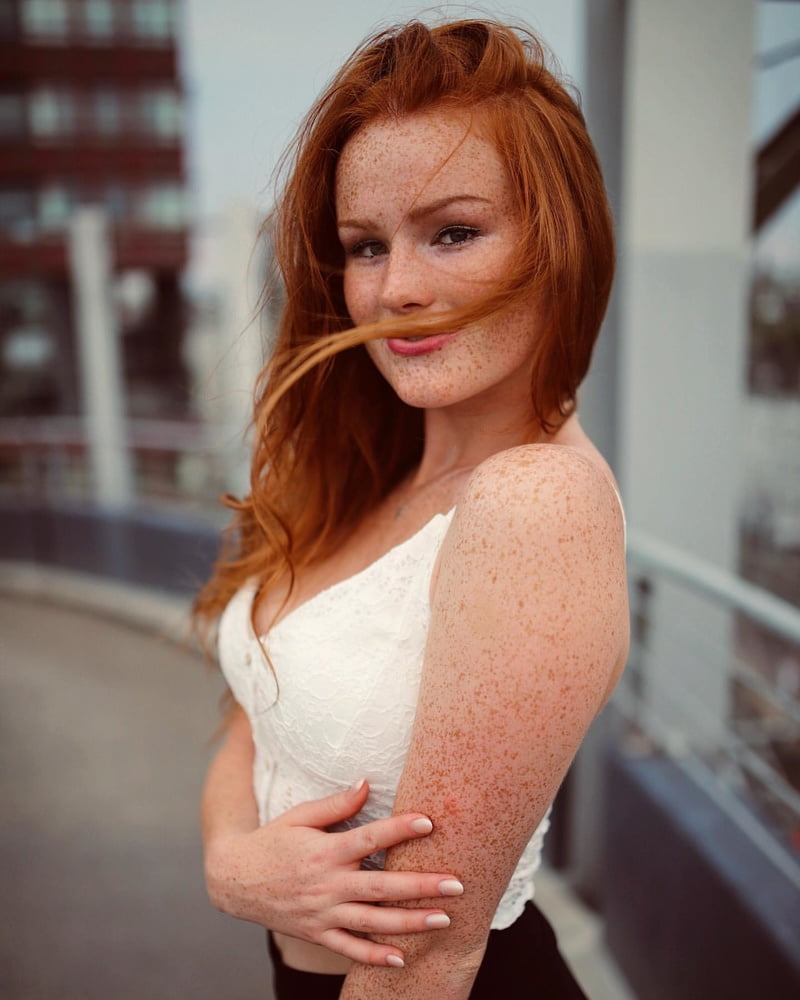 Freckled Beauty Victoria #99822621